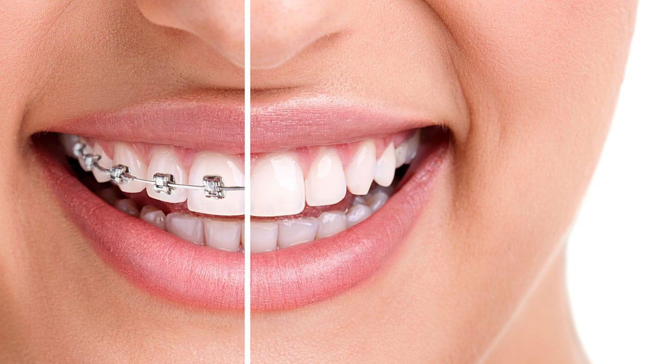 Orthodontic and Cosmetic Treatments